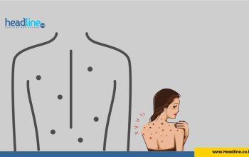 ilustrasi gambar jerawat di badan